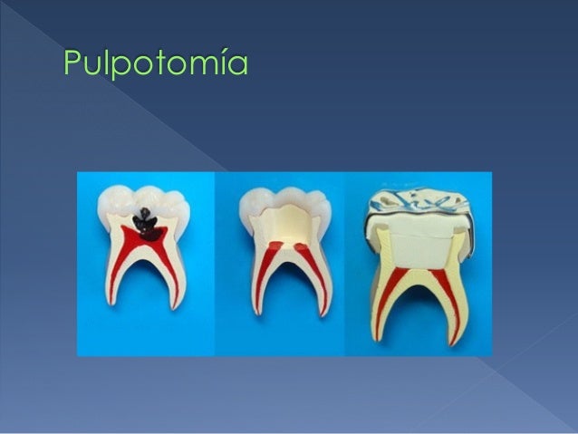 Odontopediatría