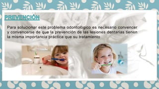 Para solucionar este problema odontológico es necesario convencer
y convencerse de que la prevención de las lesiones dentarias tienen
la misma importancia práctica que su tratamiento
 