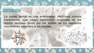 La caries dental es una enfermedad infecciosa crónica
transmisible, que causa destrucción localizada de los
tejidos dentales duros por los ácidos de los depósitos
microbianos adheridos a los dientes.
 