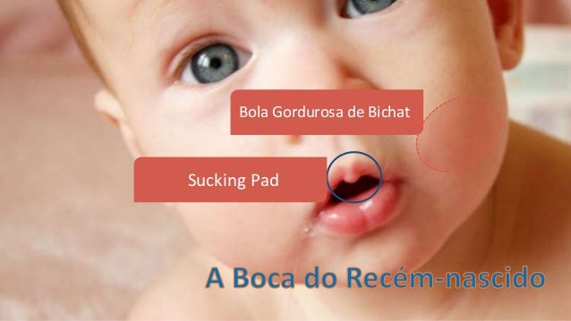 Que deixar de comer para retirar a gordura de um estômago