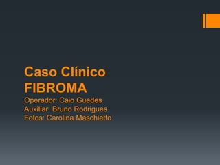 Caso Clínico
FIBROMA
Operador: Caio Guedes
Auxiliar: Bruno Rodrigues
Fotos: Carolina Maschietto

 