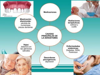 CAUSAS
PRINCIPALES DE
LA XEROSTOMÍA
Medicaciones
Radiaciones
terapéuticas:
cabeza y
cuello
Enfermedades
sistémicas:
Diabetes, SIDA,
Parkinson
Desordenes
psicogénicos:
depresión
Vejez:
deterioro en
las glándulas
salivales
Masticación
disminuida:
pérdida de
numerosas
piezas dentarias
 