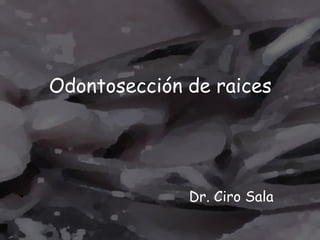 Odontosección de raices




•                 Dr. Ciro Sala
 
