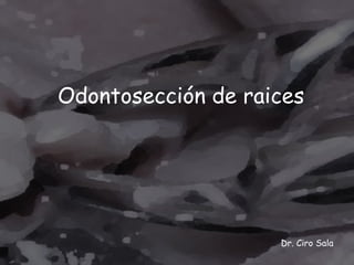 Odontosección de raices Dr. Ciro Sala 