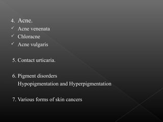 4. Acne.
 Acne venenata
 Chloracne
 Acne vulgaris
5. Contact urticaria.
6. Pigment disorders
Hypopigmentation and Hyperpigmentation
7. Various forms of skin cancers
 