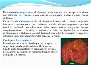 En la cirrosis compensada, el hígado presenta muchas cicatrices pero funciona
normalmente; los pacientes con cirrosis compensada suelen mostrar pocos
síntomas.
En la cirrosis descompensada, el hígado está demasiado dañado y no puede
funcionar correctamente. Los pacientes con cirrosis descompensada pueden
terminar sufriendo complicaciones tales como varices sangrantes (vasos
sanguíneos rotos en el esófago, el estómago y el sistema digestivo), acumulación
de líquidos en el abdomen (ascitis), facilidad para sufrir hemorragias o rasguños,
alteraciones mentales (encefalopatía hepática) y coma.
Carcinoma hepatocelular
Es un tipo de cáncer de hígado que puede aparecer
en personas con hepatitis crónica. El cáncer de
hígado suele desarrollarse en personas con cirrosis,
pero algunos pacientes con hepatitis B tienen cáncer
de hígado sin cirrosis.
 
