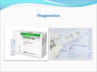 Diagnóstico
 