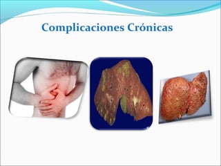 Complicaciones Crónicas
 