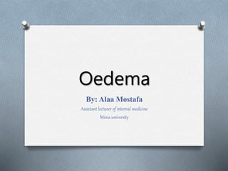 Oedema
By: Alaa Mostafa
Assistant lecturer of internal medicine
Minia university
 