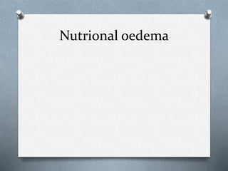 Nutrional oedema
 