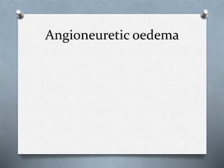 Angioneuretic oedema
 
