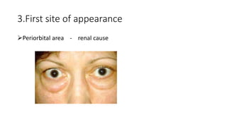 3.First site of appearance
Periorbital area - renal cause
 
