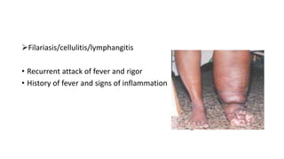Filariasis/cellulitis/lymphangitis
• Recurrent attack of fever and rigor
• History of fever and signs of inflammation
 