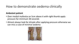 How to demonstrate oedema clinically
Ambulant patient
• Over medial malleolus or 5cm above it with right thumb apply
pressure for minimum 30 seconds
• Almost always look for dimple after applying pressure otherwise we
can miss a case of minimal oedema
 