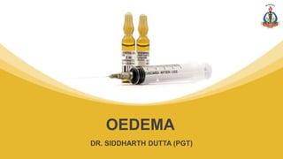 DR. SIDDHARTH DUTTA (PGT)
OEDEMA
 