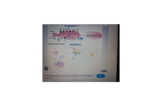 Oedema_types_causes_pathophysiology.pptx