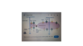 Oedema_types_causes_pathophysiology.pptx