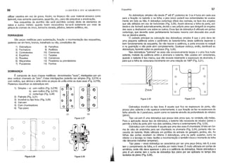 66 o EDIFICIO E SEU ACABAMENTO Esquadrias 57
utilizar vaselina em vez de graxa. Assim, na limpeza não usar material abrasivo como
bom-bril, mas somente querosene, aguarrás, etc., para não prejudicar a anodização.
Nas esquadrias de alumrnio não será permitido contato direto de elementos de
cobre e outros metais; quando forem necessários far-se-á isolamento por meio de
pintura de cromato de zinco, borracha c1orada, plástico, betume asfáltico, etc.
FERRAGENS
São peças metálicas para sustentação, fixação e movimentação das esquadrias,
podendo ser em ferro, bronze, trabalhado ou não, constiturdos de:
1) Dobradiças 8) Ferrolhos
2) Fechadura 9) Rodrzios
3) Contratestas 10) Cremonas
4) Espelhos 11) Tarjetas
5) Rosetas 12) Carrancas
6) Maçanetas 13) Fixadores ou prendedores
7) Puxadores 14) Fechos
As dobradiças simples vão desde 2" até 6"; podemos ter 3 ou 4 furos em cada asa
para a fixação no batente e na folha; o pino (eixo) poderá nas extremidades ter acaba-
mento em bola ou Mo. A dobradiça corta-fogo difere das normais, na face dos engates
que são obliqüos em vez de horizontais (Fig. 3.28). Assim abre-se a folha da porta, sol-
tando-a ela fechará automaticamente, devido o seu próprio peso que obrigará os engates
das asas a deslisarem uns sobre os outros. Esse tipo de dobradiça é utilizado em portas
corta-fogo, que deverão estar perfeitamente fechadas mesmo com descuido dos usuá-
rios ao deixá-Ia aberta.
O cuidado principal na colocação das dobradiças simples é que o pino deve ter
uma pequena saliência sobre o parâmetro do batente-folha; desta saliência depende o
bom funcionamento da esquadria. Se não houver a saliência, a porta encosta no rodapé
e na guarnição e não pode abrir completamente. Qualquer esforço, então, danificará as
dobradiças, fazendo soltar os parafusos (Fig. 3.30).
Nas dobradiças "palmela" as asas são excessivamente largas e o pino fica muito
saliente, metade da saliência entre a alvenaria e batente. São usadas em venezianas,
quando o batente é tipo marco, que não reveste totalmente a espessura da alvenaria, e
para que a folha da veneziana movimente em uma rotação de 1800 (Fig. 3.31).
o
O
[]
O
O
Figura 3.30 Figura 3.31
Dobradiça invisrvel ou tipo liceu é aquela que fica na espessura da porta, não
possui pino saliente e não aparece externamente; a sua fixação se faz na espessura da
folha através de 2 parafusos, assim como no batente através da profundidade do rebaixo
(jabre).
Tipo vai-vem é uma dobradiça que possui dois pinos que, na verdade, são molas.
Para a aplicação desse tipo de dobradiça, o batente não necessita de rebaixo (jabre) e
permite a folha da porta abrir nos dois sentidos, interna e externamente (Fig. 3.33).
Dobradiça com chumbador é aquela que uma das asas é chumbada; é. feita em for-
ma de rabo de andorinha para ser chumbada na alvenaria (Fig. 3.34), portanto não ne-
cessita de batente. Muito utilizada em portões de entrada de garagem, jardins, etc. As
folhas das portas recebem no mrnimo 3 dobradiças, uma na parte superior, outra na
inferior e a terceira no meio; facilita a movimentação e também trava o montante da folha
não deixando trabalhar (empenar).
Tipo piano - essa dobradiça se caracteriza por ser uma peça única, isto é, a asa
tem o comprimento da folha, e é vendida por metro linear. É muito utilizada em portas de
armários, onde não deve aparecer o pino e a saliência da dobradiça. Nesta dobradiça o
pino ê um arame; tem o nume de dobradiça tipo plano por ser aplicada no tampo dos
teclados do plano (Flg. 3.32).
Figura 3.29
(A) (B)
Figura 3.27
Figura 3.28
1) Simples -a) com rodrzio (Fig. 3.278)
O O O O
b) sem rodrzio (Fig. 3.27A)
O II11 O
c) corta-fogo (Fig. 3.28)
2) Palmela (Fig. 3.31)
O no f} ()
3) Invisrvel ou tipo liceu (Fig. 3.29)
4) Vai-vem
5) Com chumbadores
O O
(} O
6) Tipo piano
DOBRADiÇA
É composta de duas chapas metálicas denominadas "asas", interligadas por um
eixo vertical chamado de "pino". Estas interligações poderão ser simples (Fig. 3.27A) e
com rodrzio, que diminui o atrito entre as peças de união entre as duas asas (Fig. 3.278).
Podemos classificar as dobradiças em:
o ~ O
I I
I
O I
O
I
O
~
O
O I
O
I I
I I
O
I I
O
I I
I I
 