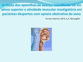 O efeito dos aparelhos de avanço mandibular na via
aérea superior e atividade muscular mastigatória em
pacientes despertos com apneia obstrutiva do sono
Ferman Johal A1, Gill G, A, K. McLaughlin
 