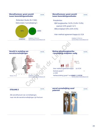 11
Wervelfracturen: groot verschil
tussen beoordelingsmethoden
Rotterdam Studie (N=7,582)
Deformiteit (“vormafwijking”)
Hoofdstuk 3.2 Oei et al.
Journal of Bone mineral Research 2017ONEENS
EENS90% 10%
Prevalenties:
▪ QM hoogteverlies 14.2% (13.4%-15.0%)
▪waarvan 6.0% graad 2 of 3
▪ ABQ eindplaat 4.0% (3.6%-4.5%)
▪ Inter-method agreement kappa (κ): 0.24
Hoofdstuk 3.2 Oei et al.
Journal of Bone mineral Research 2017
Wervelfracturen: groot verschil
tussen beoordelingsmethoden
Niveau’s T4-L4
Verschil in verdeling van
wervelvormafwijkingen
Hoofdstuk 3.2 Oei et al.
Journal of Bone mineral Research 2017
Inter-method agreement kappa (κ)=0.24
Exclusie graad 1 ->
κ=0.40
Herbeoordeling graad 1 eindplaat -> κ=0.50Hoofdstuk 3.2 Oei et al.
Journal of Bone mineral Research 2017
Meting wervelhoogteverlies
+beoordeling eindplaten nodig
STELLING 2
Alle wervelfracturen zijn vormafwijkingen,
maar niet alle wervelvormafwijkingen zijn fracturen
Ziekte van Scheuermann:
wervel vormafwijking vanaf
puberteit
C
opyrightdr.Ling
O
ei
 