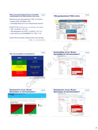 7
TBS is een osteoporotische fractuur voorspeller
onafhankelijk van de FRAX klinische risico score
Deelnemer-niveau meta-analyse (N=17.809, 14 cohorten)
• Baseline FRAX, DXA-BMD en TBS
• Gemiddelde follow-up 6.7j voor osteoporotische fracturen
Gradient of risk (GR: hazard ratio per 1 SD verandering in risico variabele)
• TBS: 1.44 (95%CI: 1.35–1.53)
• TBS geadjusteerd voor FRAX: 1.32 (95%CI: 1.24–1.41)
• Area under the curve FRAX&BMD 0.74, +TBS -> 0.79
(niet dat TBS het probleem volledig verhelpt, maar het helpt)
McCloskey, ..., Oei, ... et al. J Bone Miner Res 2015
TBS adjusted FRAX
TBS adjusted FRAX
TBS-geadjusteerde FRAX online
TBS: Hoe de getallen te interpreteren?
http://www.medimaps.fr/tbs-insight
Based on McCloskey et all. J Bone Miner Res 2016
Normaal
T-score ≥ -1
Osteoporose
T-score ≤ -2.5
Osteopenie
-1 < T-score < -2.5
Normaal
TBS ≥ 1.31
Deels gedegradeerd
1.23 < TBS < 1.31
Gedegradeerd
TBS ≤ 1.23 TBS adjusted FRAX
TBS adjusted FRAX
Kaukasische vrouw, 58 jaar:
Behandelen of niet behandelen?
TBS adjusted FRAX
TBS adjusted FRAX
Kaukasische vrouw, 58 jaar:
Behandelen of niet behandelen?
TBS adjusted FRAX
TBS adjusted FRAX
Kaukasische vrouw, 58 jaar:
Behandelen of niet behandelen?
C
opyrightdr.Ling
O
ei
 