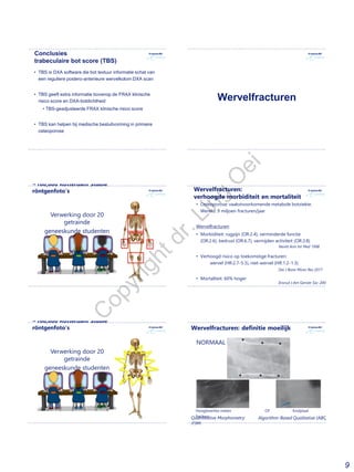 9
Conclusies
trabeculaire bot score (TBS)
• TBS is DXA software die bot textuur informatie schat van
een reguliere postero-anterieure wervelkolom DXA scan
• TBS geeft extra informatie bovenop de FRAX klinische
risico score en DXA-botdichtheid
• TBS-geadjusteerde FRAX klinische risico score
• TBS kan helpen bij medische besluitvorming in primaire
osteoporose
Wervelfracturen
~100,000 Rotterdam Studie
röntgenfoto’s
Verwerking door 20
getrainde
geneeskunde studenten
Wervelfracturen:
verhoogde morbiditeit en mortaliteit
• Osteoporose: vaakstvoorkomende metabole botziekte.
Wereld: 9 miljoen fracturen/jaar
Wervelfracturen:
• Morbiditeit: rugpijn (OR:2.4), verminderde functie
(OR:2.6), bedrust (OR:6.7), vermijden activiteit (OR:3.8)
• Verhoogd risico op toekomstige fracturen:
wervel (HR:2.7-5.3), niet-wervel (HR:1.2-1.3)
• Mortaliteit: 60% hoger
Ensrud J Am Geriatr Soc 2000
Oei J Bone Miner Res 2017
Nevitt Ann Int Med 1998
~100,000 Rotterdam Studie
röntgenfoto’s
Verwerking door 20
getrainde
geneeskunde studenten
Wervelfracturen: definitie moeilijk
Hoogteverlies meten OF Eindplaat
fractuur
NORMAAL
Quantitative Morphometry
(QM)
Algorithm-Based Qualitative (ABQ)
C
opyrightdr.Ling
O
ei
 