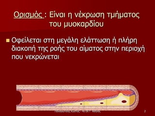 Ορισμός : Είναι η νέκρωση τμήματος
του μυοκαρδίου
 Οφείλεται στη μεγάλη ελάττωση ή πλήρη
διακοπή της ροής του αίματος στην περιοχή
που νεκρώνεται
Παναγιωτίδης Κώστας - 4ο ΕΚ Γ' Αθήνας 2
 