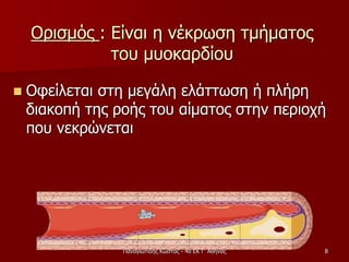 Ορισμός : Είναι η νέκρωση τμήματος
του μυοκαρδίου
 Οφείλεται στη μεγάλη ελάττωση ή πλήρη
διακοπή της ροής του αίματος στην περιοχή
που νεκρώνεται
Παναγιωτίδης Κώστας - 4ο ΕΚ Γ' Αθήνας 8
 