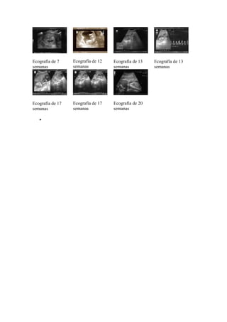 Ecografía de 7    Ecografía de 12   Ecografía de 13   Ecografía de 13
semanas           semanas           semanas           semanas




Ecografía de 17   Ecografía de 17   Ecografía de 20
semanas           semanas           semanas

   •
 