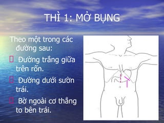 THÌ 1: MỞ BỤNG
Theo một trong các
đường sau:
Đường trắng giữa
trên rốn.
Đường dưới sườn
trái.
Bờ ngoài cơ thẳng
to bên trái.
 