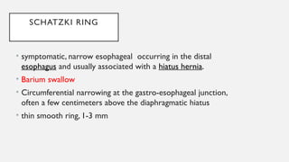 OESOPHAGEAL ANATOMY AND PATHOLOGIES (2) [Autosaved].pptx