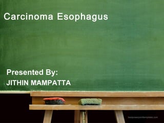 bestpowerpointtemplates.com
Carcinoma Esophagus
Presented By:
JITHIN MAMPATTA
 
