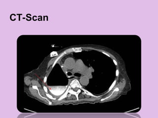 CT-Scan
 