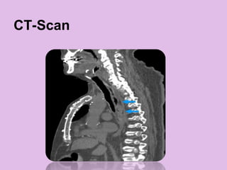 CT-Scan
 