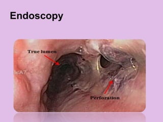 Endoscopy
 