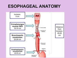 ESOPHAGEAL ANATOMY
Incisiors
0 cm
Cricopharyngus
muscle /UES
10-15 cm
Esophagogastric
Junction/LES
40-45 cm
Bronchoaortic
constriction
22-24 cm
Distance
from
Incisiors
40-45
cm
 