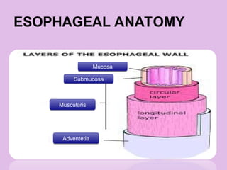 ESOPHAGEAL ANATOMY
Mucosa
Submucosa
Muscularis
Adventetia
 
