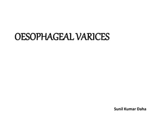 OESOPHAGEAL VARICES
Sunil Kumar Daha
 