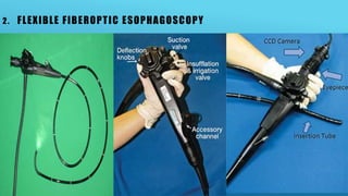 2. FLEXIBLE FIBEROPTIC ESOPHAGOSCOPY
 
