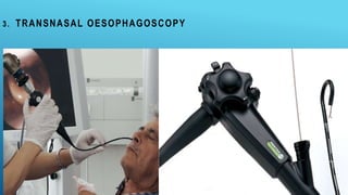 3. TRANSNASAL OESOPHAGOSCOPY
 