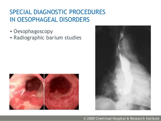 Oesophagus congenital anomalies, motor dysfunction, gerd and tumour…