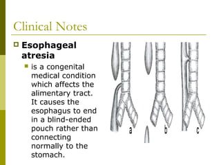 Clinical Notes
 Esophageal
atresia
 is a congenital
medical condition
which affects the
alimentary tract.
It causes the
esophagus to end
in a blind-ended
pouch rather than
connecting
normally to the
stomach.
 