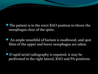 Oesophagus ppt for ss | PPT