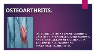 OSTEOARTHRITIS.
OSTEOARTHRITIS: A TYPE OF ARTHRITIS
CAUSED BY INFLAMMATION, BREAKDOWN,
AND EVENTUAL LOSS OF CARTILAGE IN
THE JOINTS. ALSO KNOWN AS
DEGENERATIVE ARTHRITIS.
 