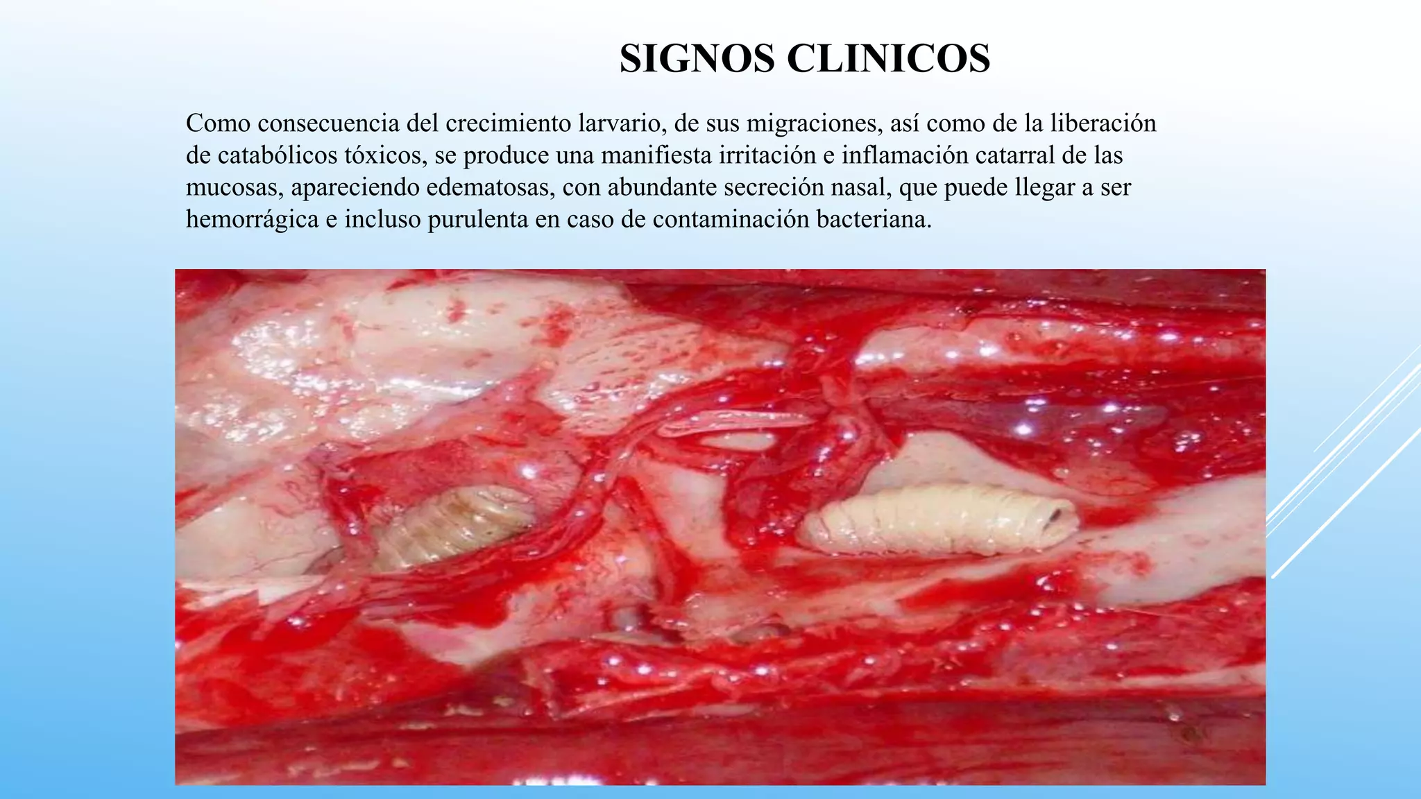 Como consecuencia del crecimiento larvario, de sus migraciones, así como de la liberación
de catabólicos tóxicos, se produce una manifiesta irritación e inflamación catarral de las
mucosas, apareciendo edematosas, con abundante secreción nasal, que puede llegar a ser
hemorrágica e incluso purulenta en caso de contaminación bacteriana.
SIGNOS CLINICOS
 
