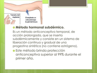  Método hormonal subdérmico.
Es un método anticonceptivo temporal, de
acción prolongada, que se inserta
subdérmicamente y consiste en un sistema de
liberación continua y gradual de una
progestina sintética (no contiene estrógeno).
 Este método brinda protección
anticonceptiva superior al 99% durante el
primer año.
 