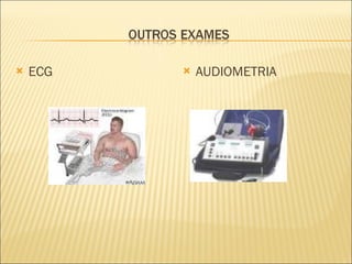 ECG AUDIOMETRIA 