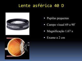 Lente asférica 40 D

           Pupilas pequenas

           Campo visual 69 a 90º

           Magnificação 1.67 x

           Exame a 2 cm
 