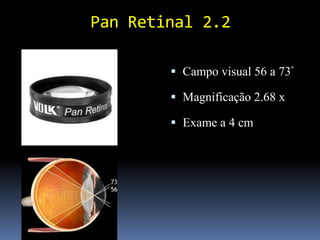 Pan Retinal 2.2

         Campo visual 56 a 73º

         Magnificação 2.68 x

         Exame a 4 cm
 