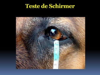 Teste de Schirmer
 